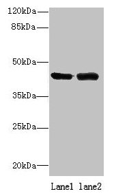 Immunohistochemistry of paraffin-embedded human breast cancer using CAC14452 at dilution of 1:100