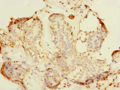 Immunohistochemistry of paraffin-embedded human adrenal gland tissue using CAC14452 at dilution of 1:100