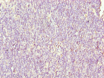 SH3BGRL3 Polyclonal Antibody - image 4