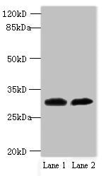 Immunohistochemistry of paraffin-embedded human colon cancer using CAC14458 at dilution of 1:100