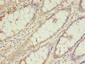 TRNAU1AP Polyclonal Antibody - image 3
