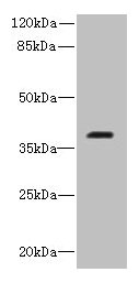 Immunohistochemistry of paraffin-embedded human liver cancer using CAC14469 at dilution of 1:100