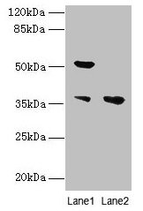 Immunohistochemistry of paraffin-embedded human endometrial cancer using CAC14494 at dilution of 1:100