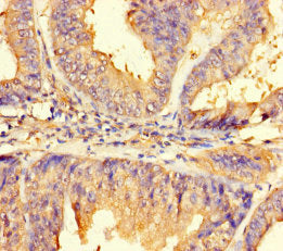 Immunohistochemistry of paraffin-embedded human kidney tissue using CAC14494 at dilution of 1:100