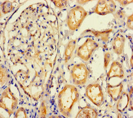 IMPACT Polyclonal Antibody - image 4