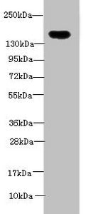 Immunohistochemistry of paraffin-embedded human brain tissue using CAC14501 at dilution of 1:100