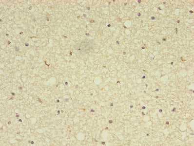 ADAMTS7 Polyclonal Antibody - image 3