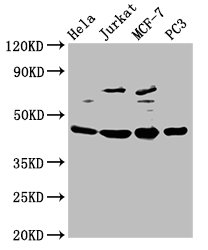 Immunohistochemistry of paraffin-embedded human breast cancer using CAC14503 at dilution of 1:100