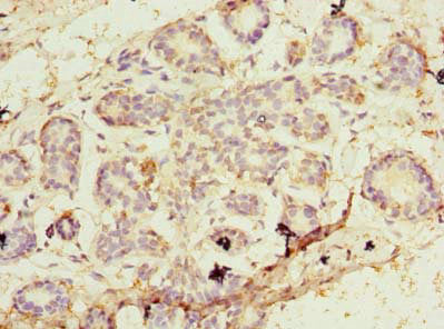 Immunohistochemistry of paraffin-embedded human kidney tissue using CAC14503 at dilution of 1:100