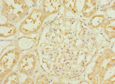 Immunofluorescence staining of MCF-7 cells with CAC14503 at 1:166, counter-stained with DAPI. The cells were fixed in 4% formaldehyde, permeabilized using 0.2% Triton X-100 and blocked in 10% normal Goat Serum. The cells were then incubated with the antibody overnight at 4°C. The secondary antibody was Alexa Fluor 488-congugated AffiniPure Goat Anti-Rabbit IgG(H+L).