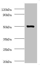 Immunohistochemistry of paraffin-embedded human melanoma using CAC14516 at dilution of 1:100