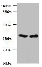 Immunohistochemistry of paraffin-embedded human tonsil tissue using CAC14517 at dilution of 1:100
