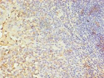 Immunohistochemistry of paraffin-embedded human skeletal muscle tissue using CAC14517 at dilution of 1:100