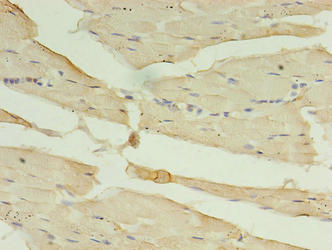 CA5B Polyclonal Antibody - image 4