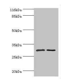 Immunofluorescent analysis of Hela cells using CAC14519 at dilution of 1:100 and Alexa Fluor 488-congugated AffiniPure Goat Anti-Rabbit IgG(H+L)