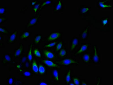 SRPRB Polyclonal Antibody - image 3
