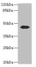 Immunohistochemistry of paraffin-embedded human testis tissue using CAC14525 at dilution of 1:100
