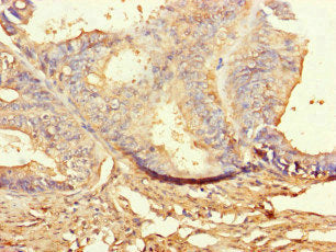 Immunofluorescent analysis of HepG2 cells using CAC14527 at dilution of 1:100 and Alexa Fluor 488-congugated AffiniPure Goat Anti-Rabbit IgG(H+L)