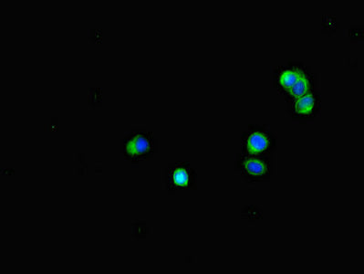 Immunoprecipitating BUB1B in JK whole cell lysate , Lane 1: Rabbit control IgG (1ug) instead of CAC14527 in Jurkat whole cell lysate., For western blotting, a HRP-conjugated Protein G antibody was used as the secondary antibody (1/2000), Lane 2: CAC14527 (6ug) + JK whole cell lysate (500ug), Lane 3: JK whole cell lysate (10ug)