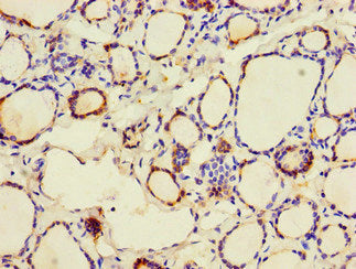 Immunofluorescent analysis of MCF-7 cells using CAC14528 at dilution of 1:100 and Alexa Fluor 488-congugated AffiniPure Goat Anti-Rabbit IgG(H+L)
