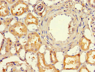 Immunofluorescent analysis of HepG2 cells using CAC14531 at dilution of 1:100 and Alexa Fluor 488-congugated AffiniPure Goat Anti-Rabbit IgG(H+L)