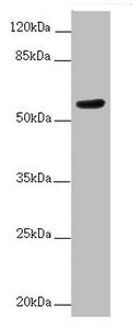 Immunofluorescent analysis of HepG2 cells using CAC14534 at dilution of 1:100 and Alexa Fluor 488-congugated AffiniPure Goat Anti-Rabbit IgG(H+L)