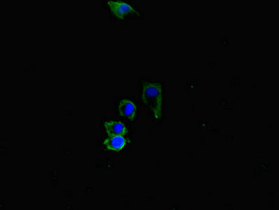 ACVRL1 Polyclonal Antibody - image 3