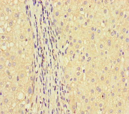 Immunofluorescent analysis of HepG2 cells using CAC14536 at dilution of 1:100 and Alexa Fluor 488-congugated AffiniPure Goat Anti-Rabbit IgG(H+L)