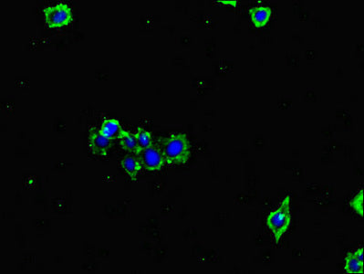 Western Blot, Positive WB detected in: Mouse liver tissue, Mouse brain tissue, All lanes: GLUL antibody at 3ug/ml, Secondary, Goat polyclonal to rabbit IgG at 1/50000 dilution, Predicted band size: 42 kDa, Observed band size: 42 kDa