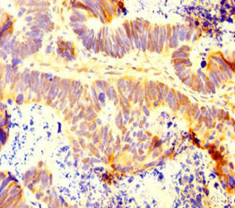 Immunofluorescent analysis of Hela cells using CAC14539 at dilution of 1:100 and Alexa Fluor 488-congugated AffiniPure Goat Anti-Rabbit IgG(H+L)