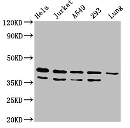 IHC image of CAC14542 diluted at 1:600 and staining in paraffin-embedded human pancreatic tissue performed on a Leica BondTM system. After dewaxing and hydration, antigen retrieval was mediated by high pressure in a citrate buffer (pH 6.0). Section was blocked with 10% normal goat serum 30min at RT. Then primary antibody (1% BSA) was incubated at 4°C overnight. The primary is detected by a biotinylated secondary antibody and visualized using an HRP conjugated SP system.