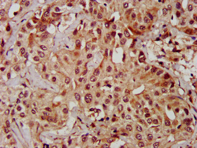 Immunofluorescent analysis of HepG2 cells using CAC14542 at dilution of 1: 100 and Alexa Fluor 488-congugated AffiniPure Goat Anti-Rabbit IgG(H+L)