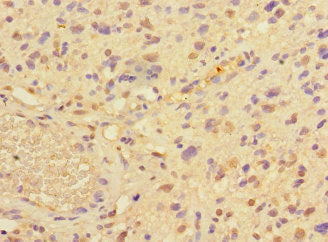 Immunofluorescent analysis of MCF-7 cells using CAC14545 at dilution of 1:100 and Alexa Fluor 488-congugated AffiniPure Goat Anti-Rabbit IgG(H+L)
