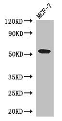 Immunohistochemistry of paraffin-embedded human liver tissue using CAC14546 at dilution of 1:100