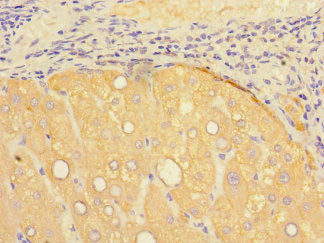 Immunohistochemistry of paraffin-embedded human brain tissue using CAC14546 at dilution of 1:100