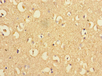 PSEN1 Polyclonal Antibody - image 4