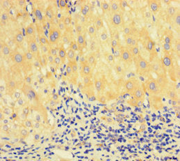 Immunofluorescent analysis of Hela cells using CAC14547 at dilution of 1:100 and Alexa Fluor 488-congugated AffiniPure Goat Anti-Rabbit IgG(H+L)