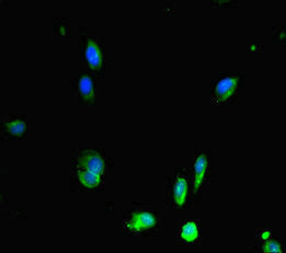 Immunoprecipitating RAD51 in K562 whole cell lysate, Lane 1: Rabbit control IgG (1ug) instead of CAC14547 in K562 whole cell lysate. For western blotting, a HRP-conjugated Protein G antibody was used as the secondary antibody (1/50000), Lane 2: CAC14547 (4ug) + K562 whole cell lysate (500ug), Lane 3: K562 whole cell lysate (20ug)