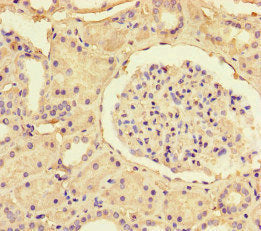 Immunofluorescent analysis of HepG2 cells using CAC14550 at dilution of 1:100 and Alexa Fluor 488-congugated AffiniPure Goat Anti-Rabbit IgG(H+L)