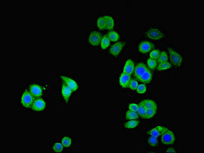 SSTR2 Polyclonal Antibody - image 5