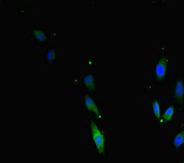 TERF2 Polyclonal Antibody - image 4