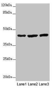 Immunohistochemistry of paraffin-embedded human skeletal muscle tissue using CAC14567 at dilution of 1:100