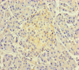 Immunofluorescent analysis of HepG2 cells using CAC14568 at dilution of 1:100 and Alexa Fluor 488-congugated AffiniPure Goat Anti-Rabbit IgG(H+L)