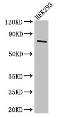 Immunohistochemistry of paraffin-embedded human pancreatic cancer using CAC14570 at dilution of 1:100