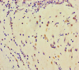 TDRD3 Polyclonal Antibody - image 4
