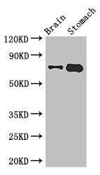 Immunohistochemistry of paraffin-embedded human testis tissue using CAC14571 at dilution of 1:100