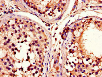 Immunofluorescent analysis of MCF-7 cells using CAC14577 at dilution of 1:100 and Alexa Fluor 488-congugated AffiniPure Goat Anti-Rabbit IgG(H+L)