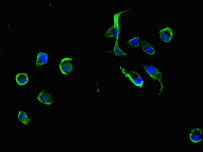 ADRM1 Polyclonal Antibody - image 4