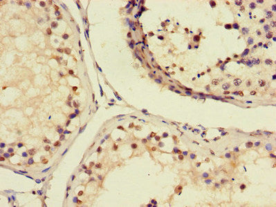 Immunofluorescent analysis of A549 cells using CAC14578 at dilution of 1:100 and Alexa Fluor 488-congugated AffiniPure Goat Anti-Rabbit IgG(H+L)