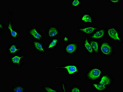 AIM2 Polyclonal Antibody - image 4
